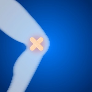 Bandverletzungen beim Sport betreffen häufig das vordere oder hintere Kreuzband