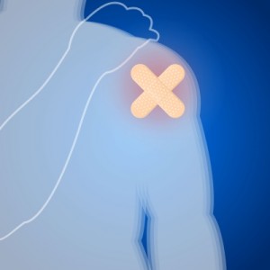 Eine ausgekugelte Schulter bereitet starke Schmerzen und bedarf einer umfassenden Therapie mit anschließender Physiotherapie zur Kräftigung der Muskulatur