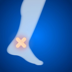 Außenbandrisse des oberen Sprunggelenks entstehen vor allem durch das Umknicken des Fußes.